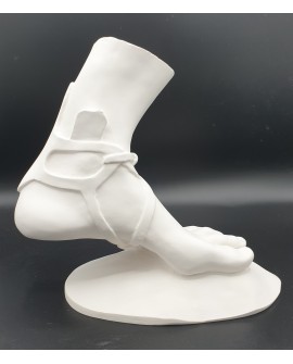 Hermes- foot in plaster.